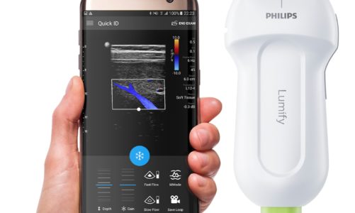 Philips Lumify – kompletne USG w smartfonie!